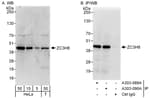Detection of human ZC3H8 by western blot and immunoprecipitation.