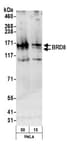 Detection of human BRD8 by western blot.