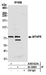 Detection of human MTHFR by western blot of immunoprecipitates.