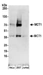 Detection of human MCT1 by western blot.