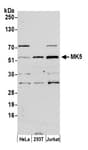 Detection of human MK5 by western blot.