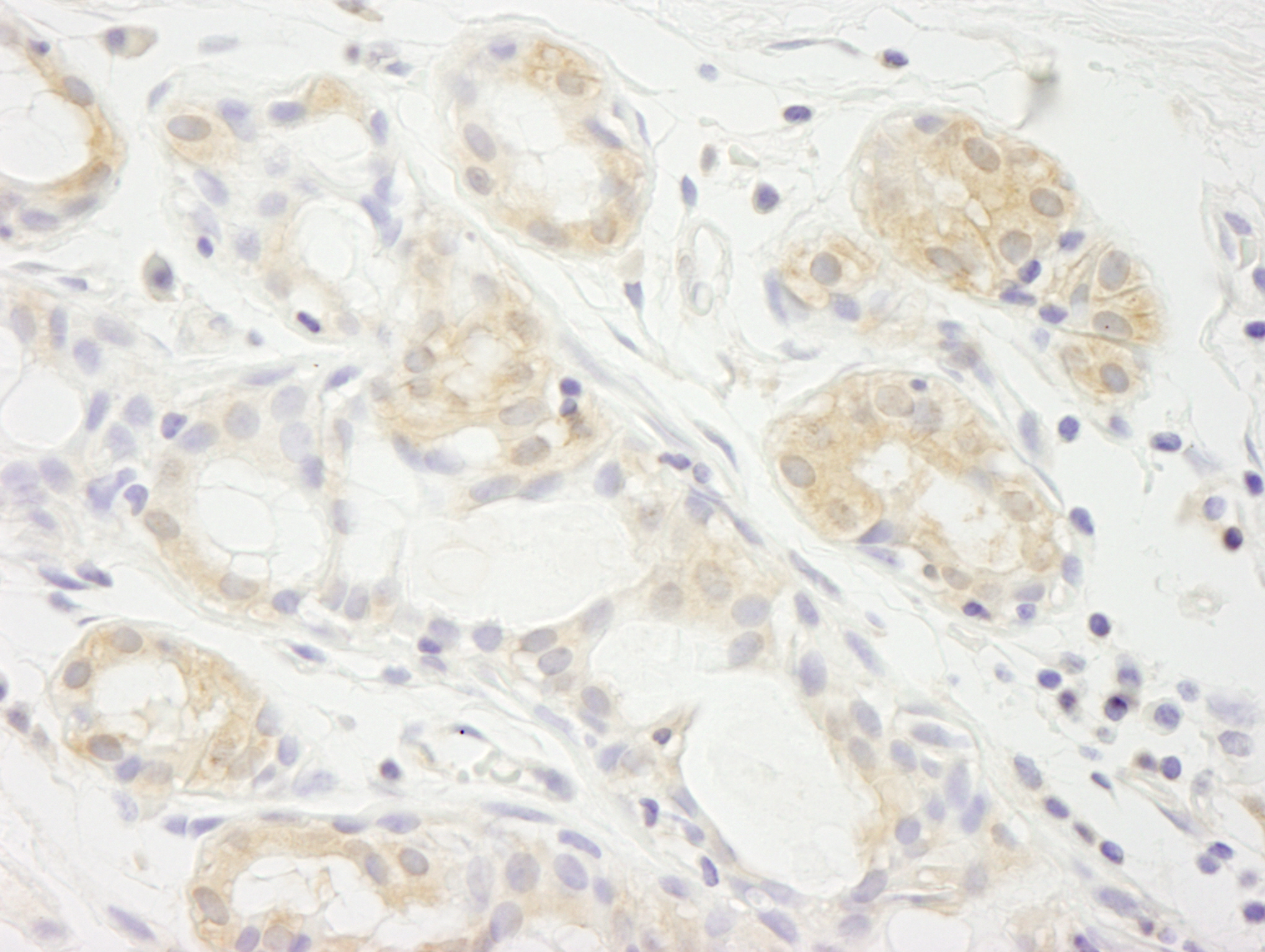 Rabbit anti-eIF2A IHC Antibody