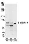 Detection of human Exportin-T by western blot.