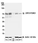 Detection of human CRTC1/TORC1 by western blot.