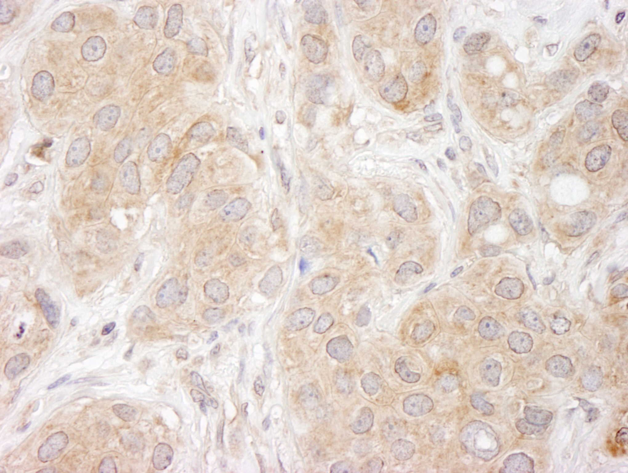 Rabbit anti-SNX1 IHC Antibody