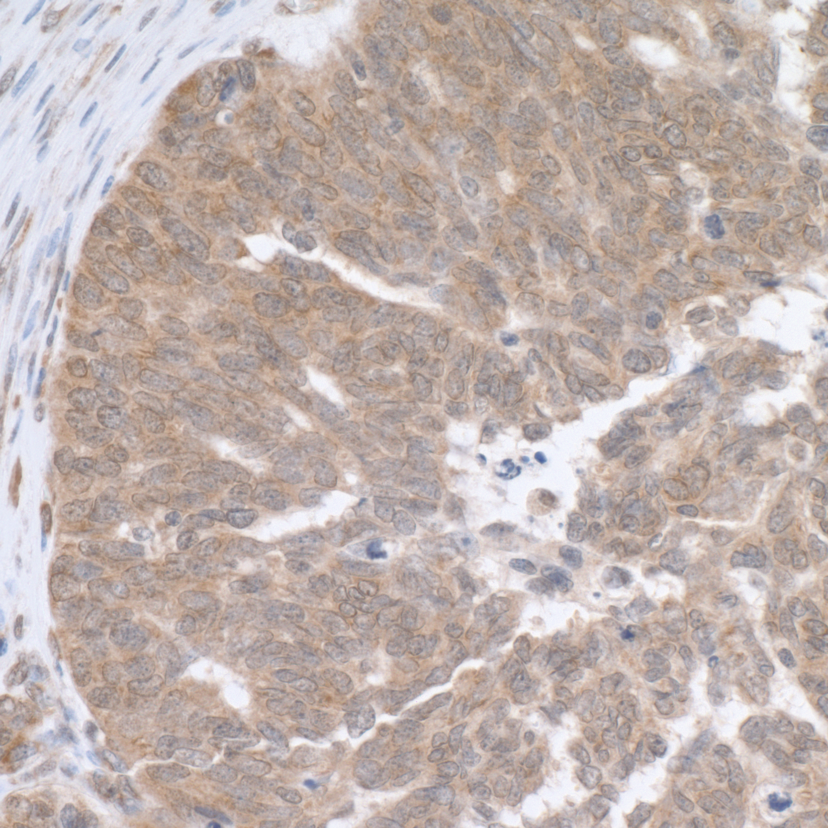 Detection of human RPL5 by immunohistochemistry.