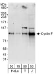 Detection of human Cyclin F by western blot.