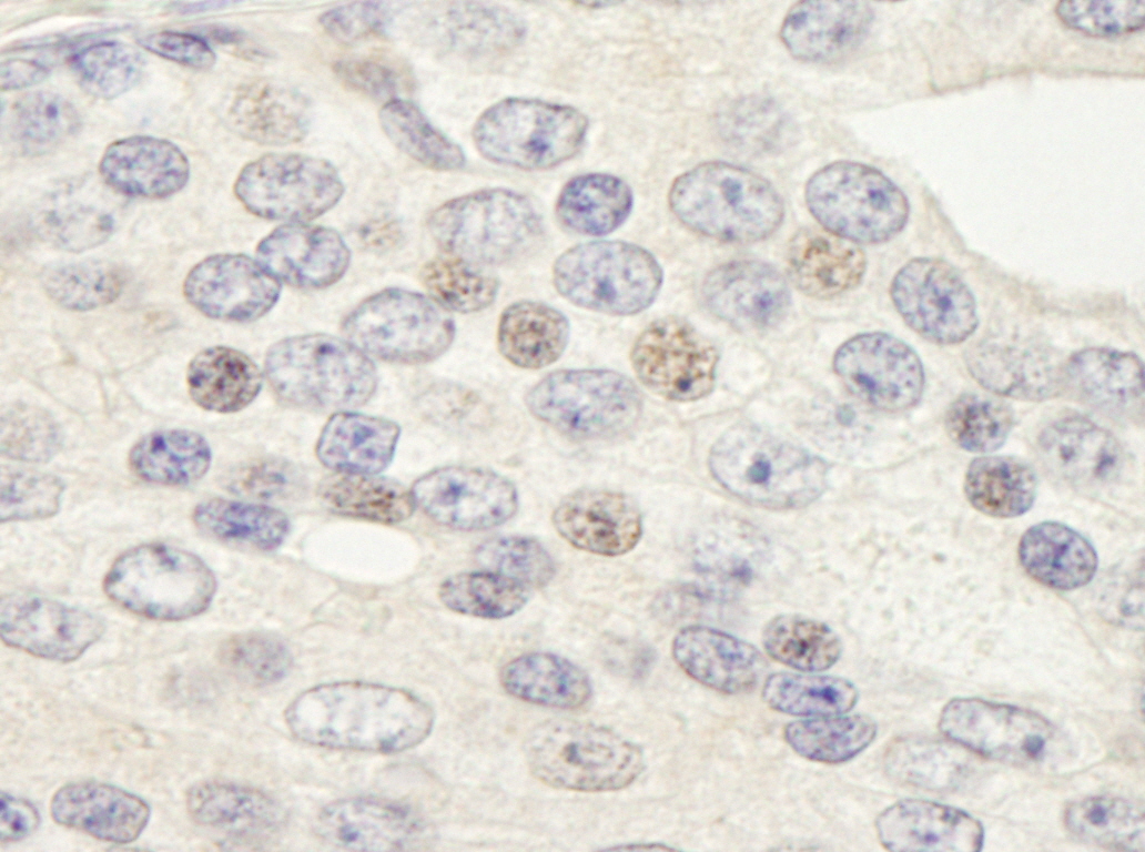 Rabbit anti-ZNF592 IHC Antibody