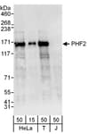 Detection of human PHF2 by western blot.