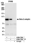 Detection of human Beta-2-adaptin by western blot of immunoprecipitates.