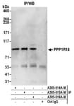 Detection of human PPP1R18 by western blot of immunoprecipitates.