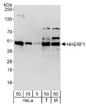 Detection of human and mouse NHERF1 by western blot.