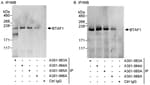 Detection of human BTAF1 by western blot of immunoprecipitates.