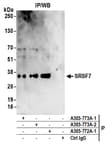 Detection of human SRSF7 by western blot of immunoprecipitates.