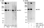 Detection of human and mouse IRS1 by western blot (h&amp;m) and immunoprecipitation (h).