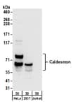 Detection of human Caldesmon by western blot.