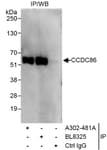 Detection of human CCDC86 by western blot of immunoprecipitates.