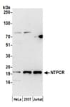 Detection of human NTPCR by western blot.