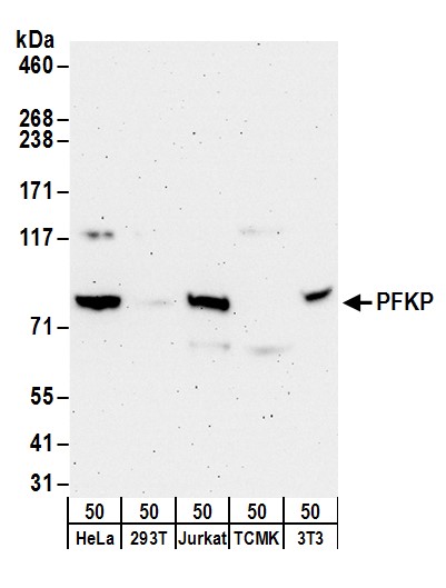 Detection of human and mouse PFKP by western blot.