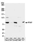 Detection of human and mouse PFKP by western blot.
