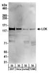 Detection of human LOK by western blot.