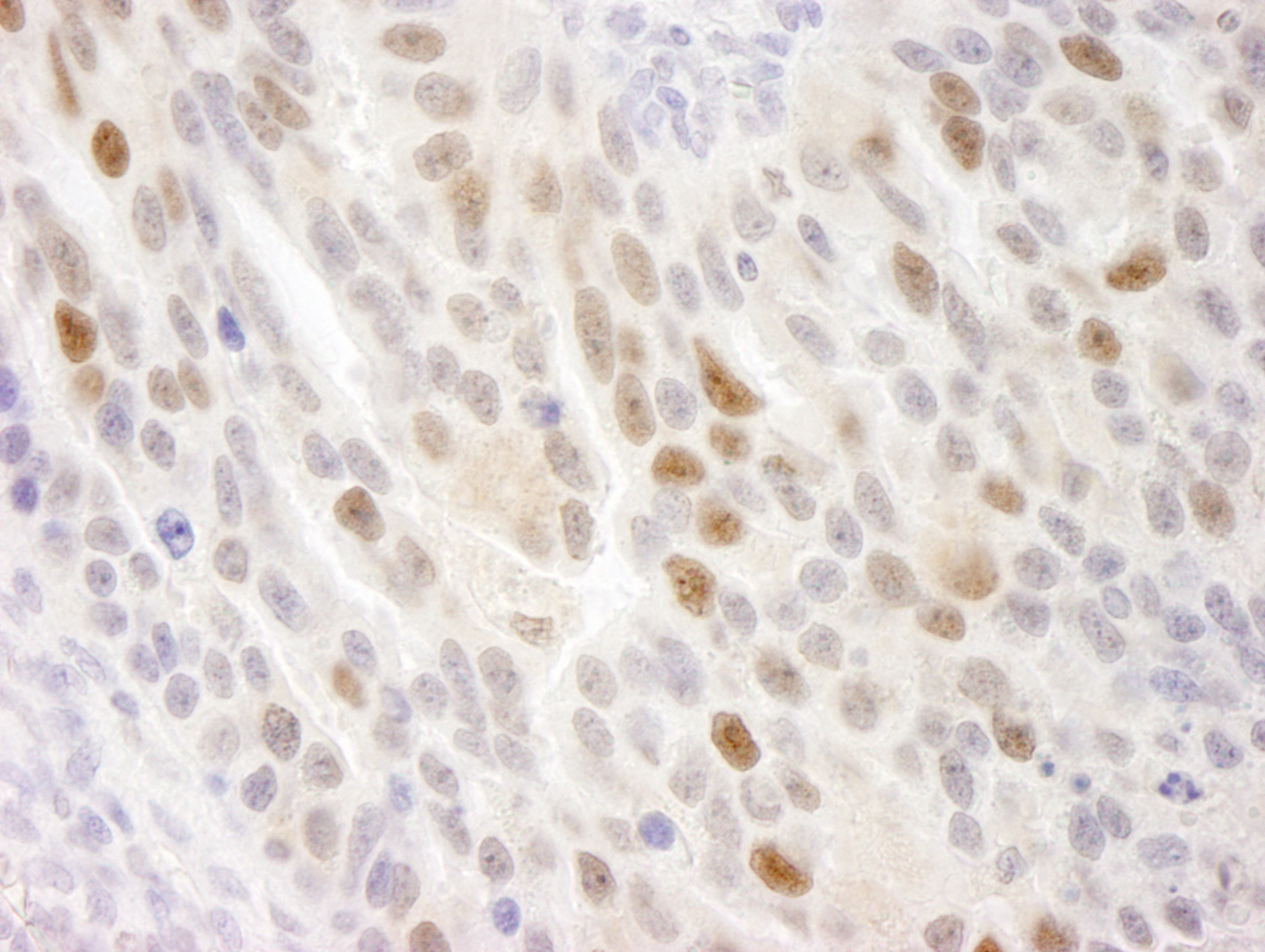 Rabbit anti-KIFC1 IHC Antibody