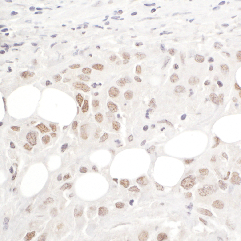 Detection of human hPrp3p by immunohistochemistry.