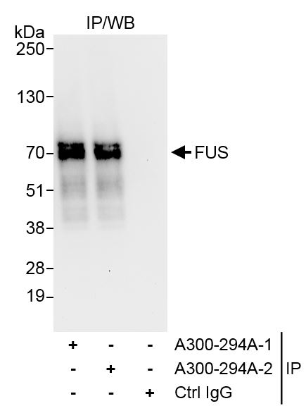 Detection of human FUS by western blot of immunoprecipitates.