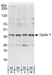 Detection of human Cyclin Y by western blot.