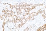 Detection of human Galectin-9/Gal-9 by immunohistochemistry.
