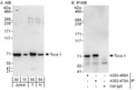 Detection of human Toca-1 by western blot and immunoprecipitation.