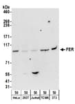 Detection of human and mouse FER by western blot.