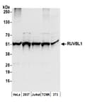 Detection of human and mouse RUVBL1 by western blot.