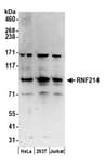 Detection of human RNF214 by western blot.