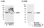 Detection of human and mouse EGR1 by western blot (h and m) and immunoprecipitation (m).