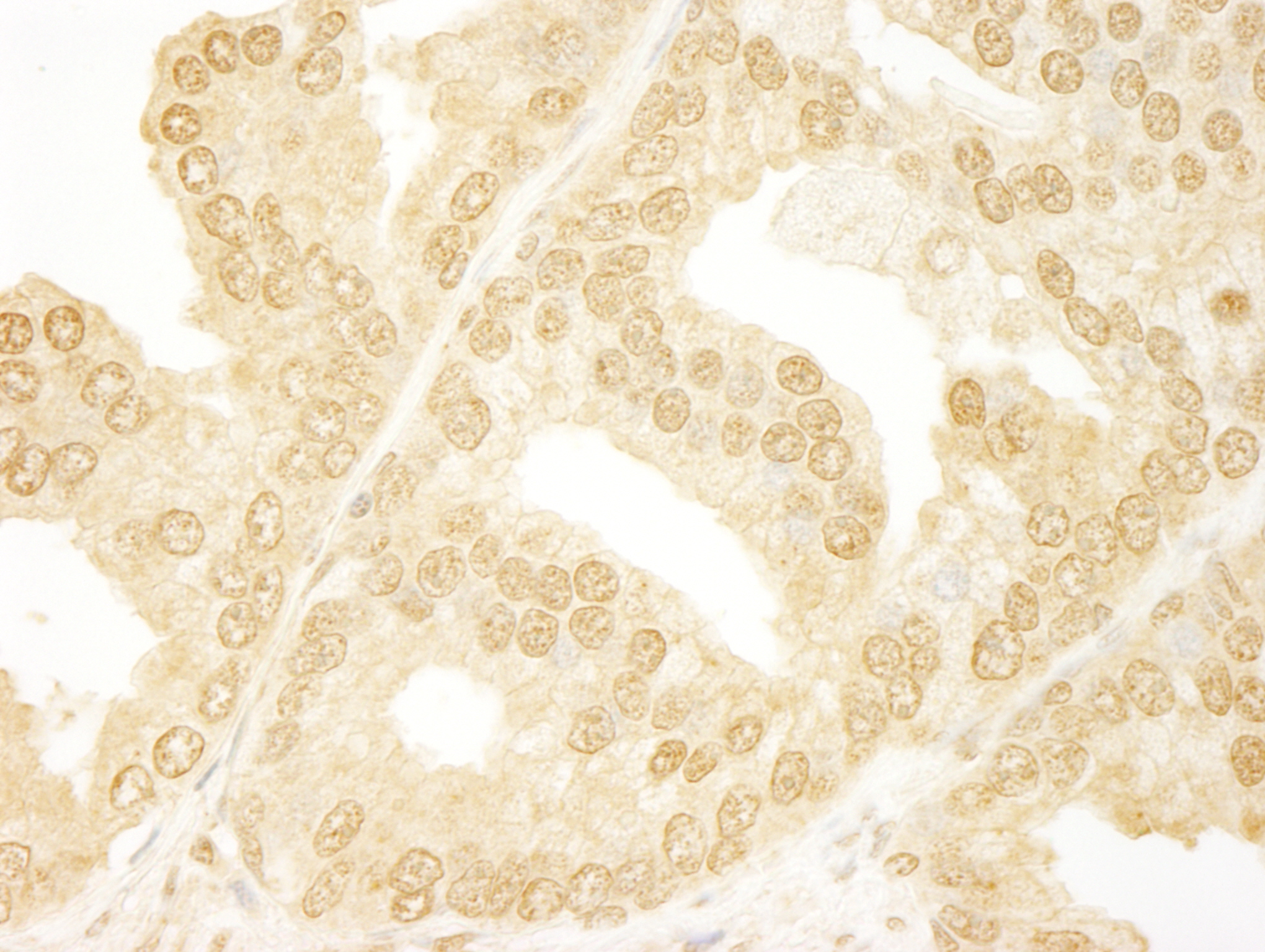 Rabbit anti-ANKRD17 IHC Antibody