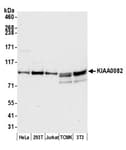 Detection of human and mouse KIAA0082 by western blot.