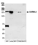 Detection of human and mouse CARMIL2 by western blot.