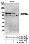 Detection of human SPATS2L by western blot of immunoprecipitates.
