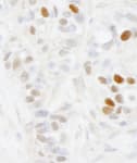 Detection of human MAGED2 by immunohistochemistry.