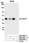 Detection of human Arpc1b by western blot of immunoprecipitates.