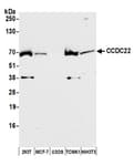 Detection of human and mouse CCDC22 by western blot.