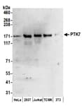 Detection of human and mouse PTK7 by western blot.