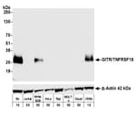 Detection of human GITR/TNFRSF18 by western blot.