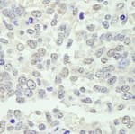 Detection of mouse KPNA3 by immunohistochemistry.