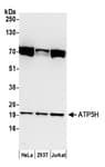 Detection of human ATP5H by western blot.