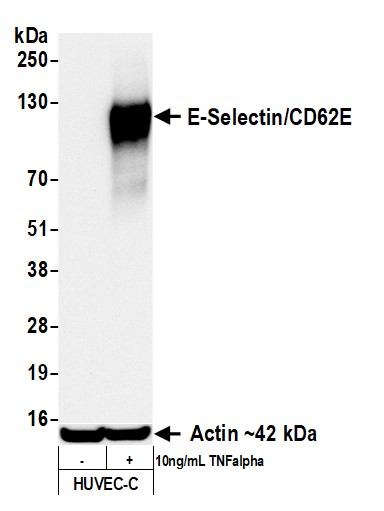 Rabbit anti-E-Selectin/CD62E Recombinant Monoclonal Antibody [BLR295L]