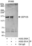 Detection of human CEP135 by western blot of immunoprecipitates.