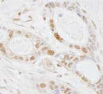 Detection of human PUS1 by immunohistochemistry.