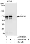 Detection of human GMEB2 by western blot of immunoprecipitates.